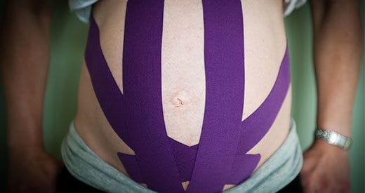 Pregnant Women Can Use Kinesiotape 5 Ways