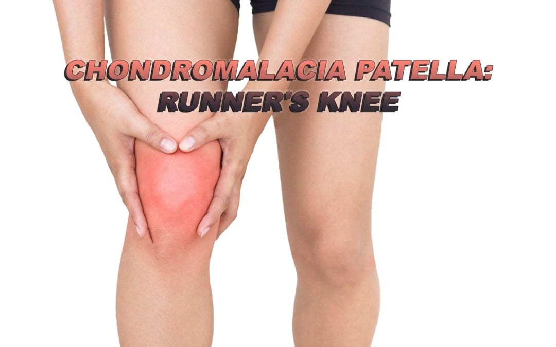 Chondromalacia Patella: Runner’s Knee