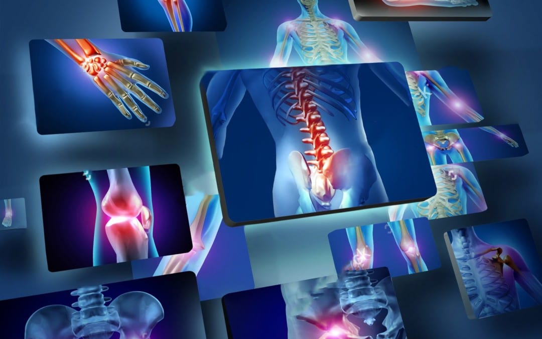 Alleviate Joint Inflammation With Chiropractic Therapy