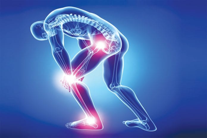 14 Home Remedies for Arthritis & Joint Pain | Everyday Roots