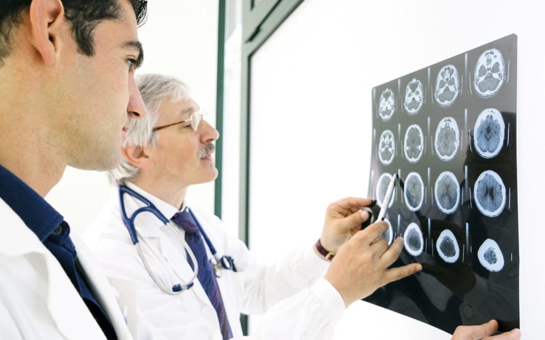 Silent Seizures Associated with Alzheimer’s Disease