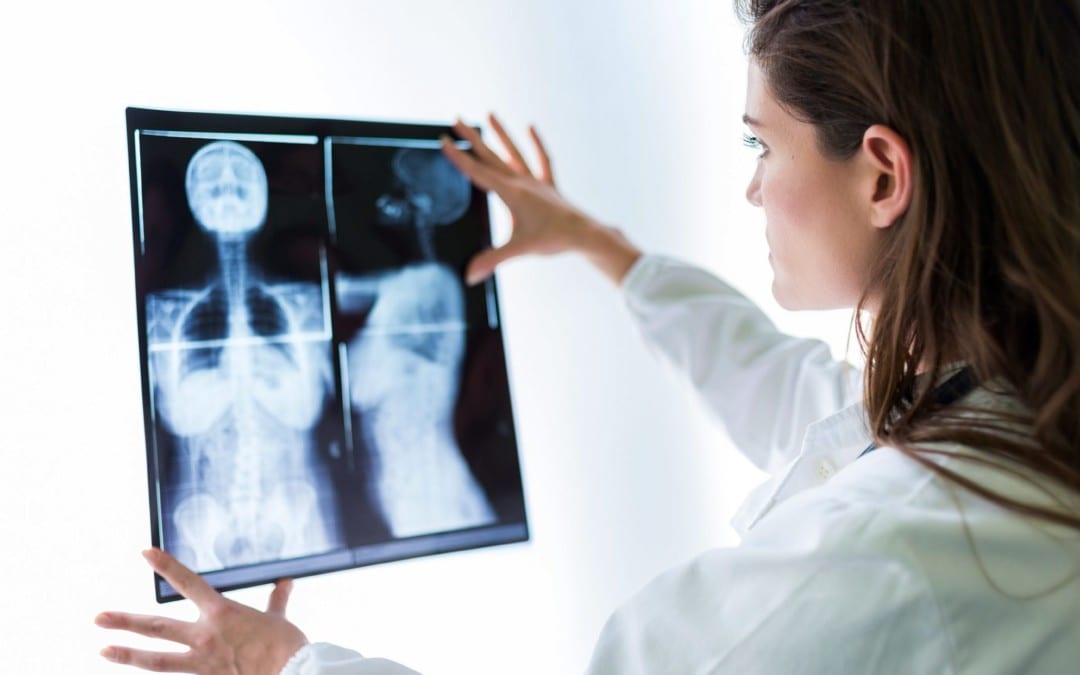 What is the Atlas Orthogonal Chiropractic Technique?