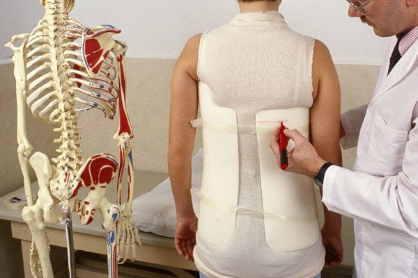 Scoliosis Treatment Options and Home Remedies