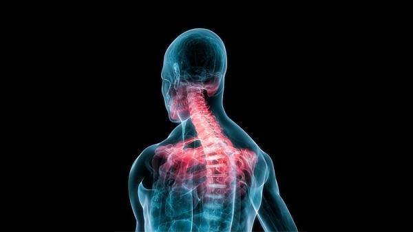 Quiropráctico del latigazo cervical: Curvaturas cervicales anormales