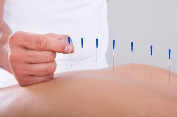 Other Alternative Treatments for Herniated Discs | Scientific Chiropractor