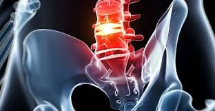 El Paso Scientific Specialist: Lumbar Herniated Discs and Sciatica