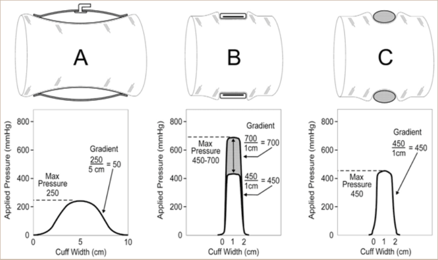Is Blood Flow Restriction Training Safe?