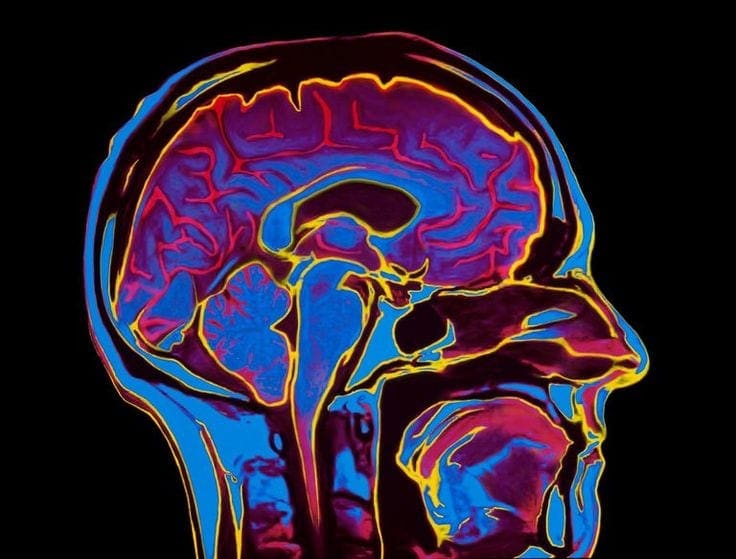 Fibromyalgia Study: It’s a Real Disease | Central Chiropractor