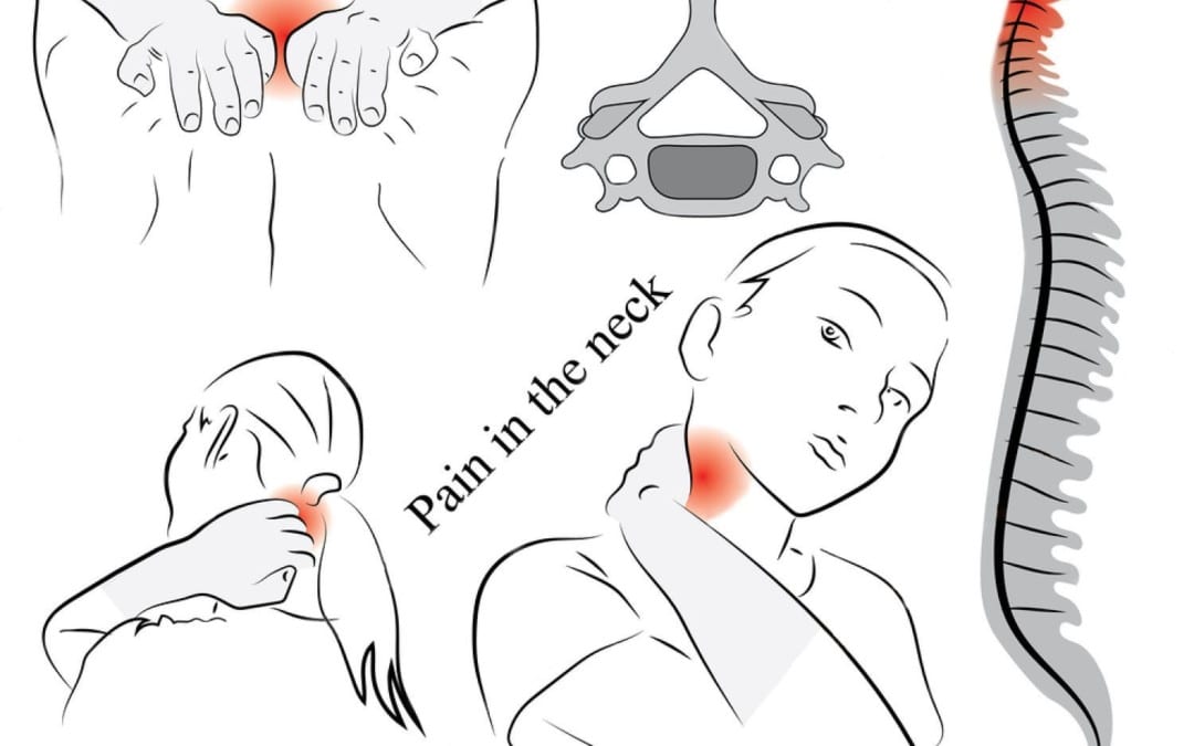 Serious Neck Pain Or Not?