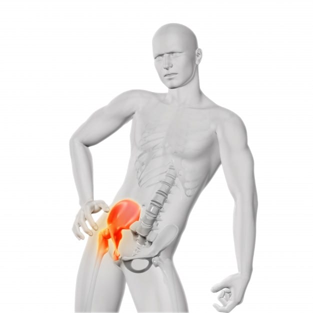 Posizionamento delle anche e Anatomia RM