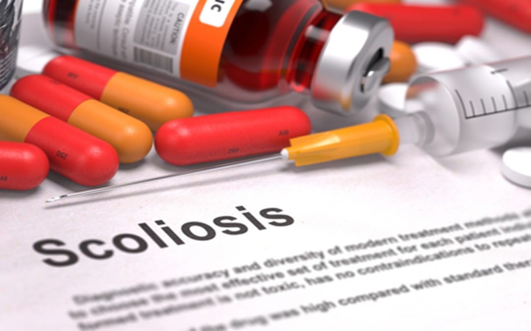 Beneficios quiroprácticos que sufren de escoliosis en El Paso, TX.
