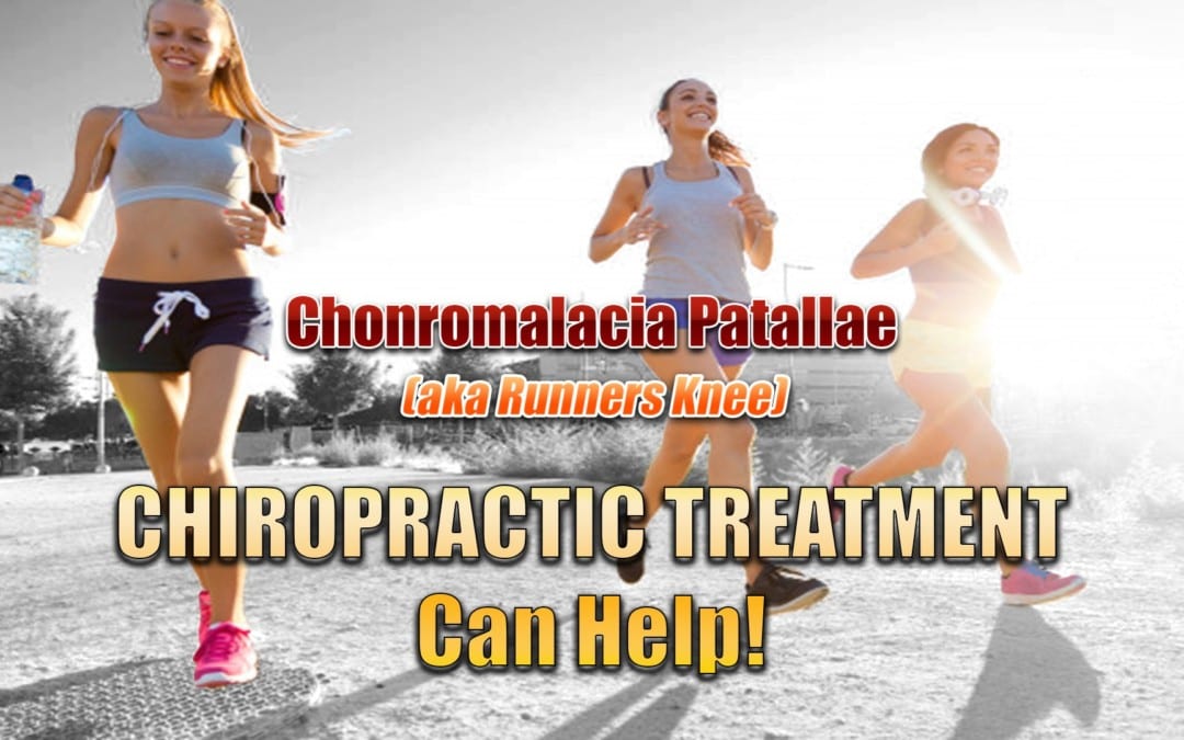 Chondromalacia Patellae, Chiropractic Treatment Can Help In El Paso, TX.