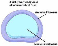 Axial View of Intervertebral Disc | El Paso, TX Chiropractor
