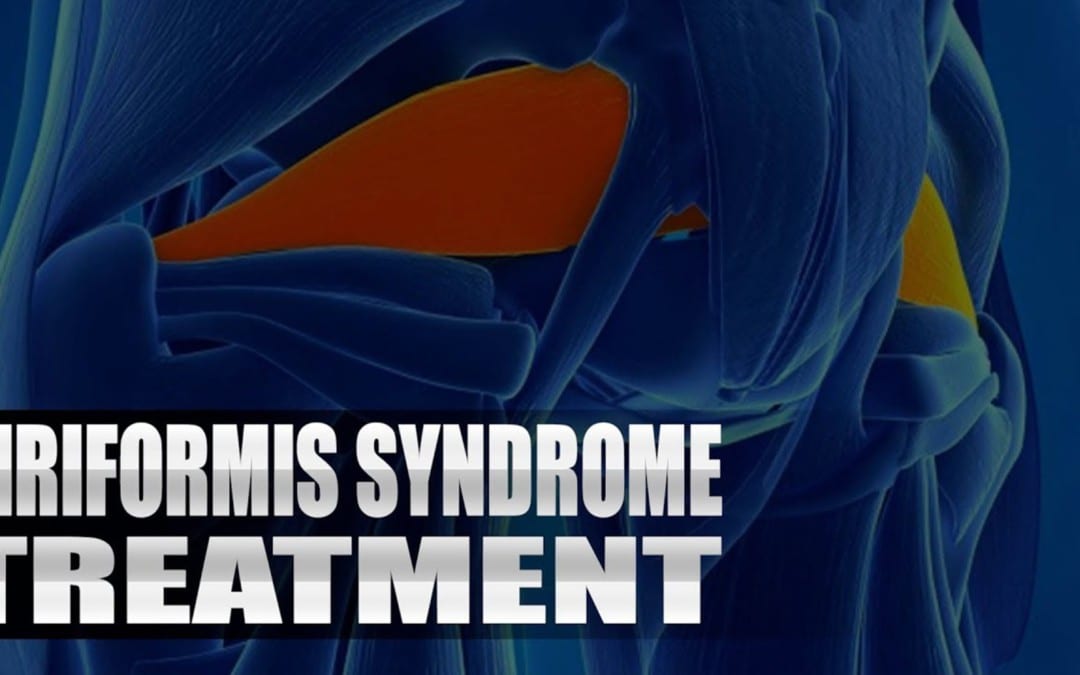 Piriformis Syndrome Treatment Chiropractor | El Paso, TX. | Video