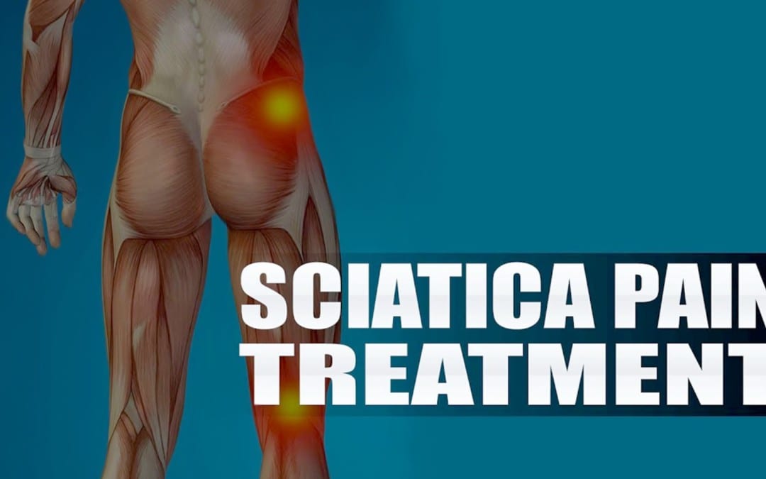Chiropractic Therapy For Sciatica Pain | El Paso, TX. | Video