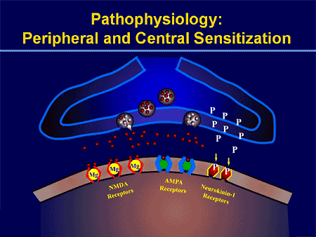 Peripheral and Central Sensitization | El Paso, TX Chiropractor