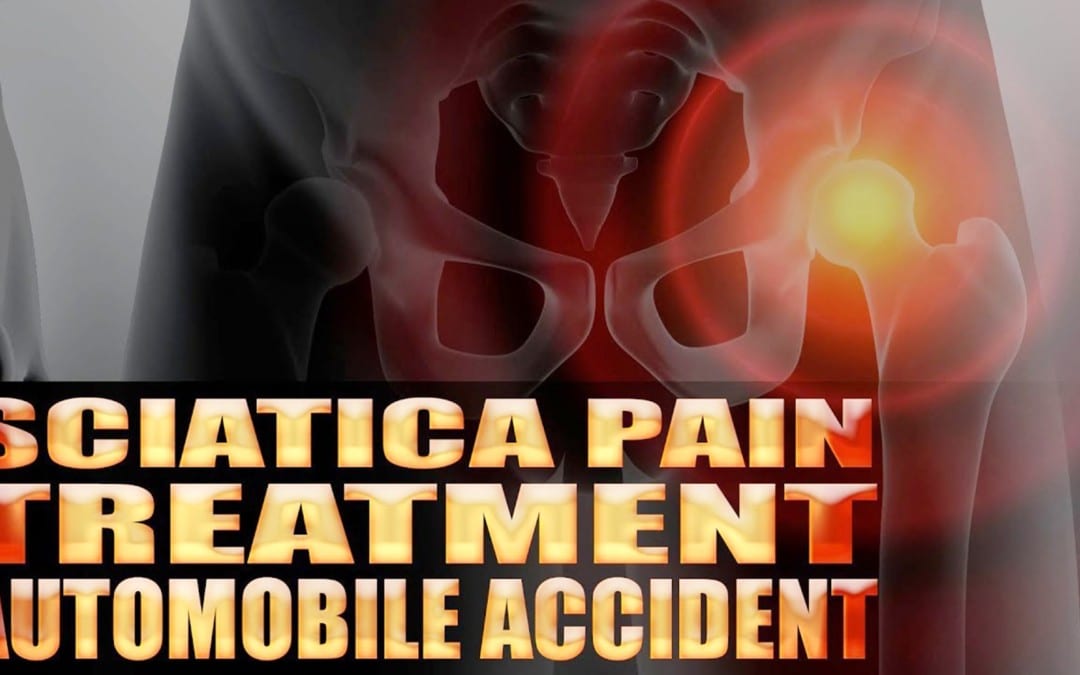 Tratamiento de dolor de ciática en El Paso, TX Cuidado de quiropráctica | Vídeo