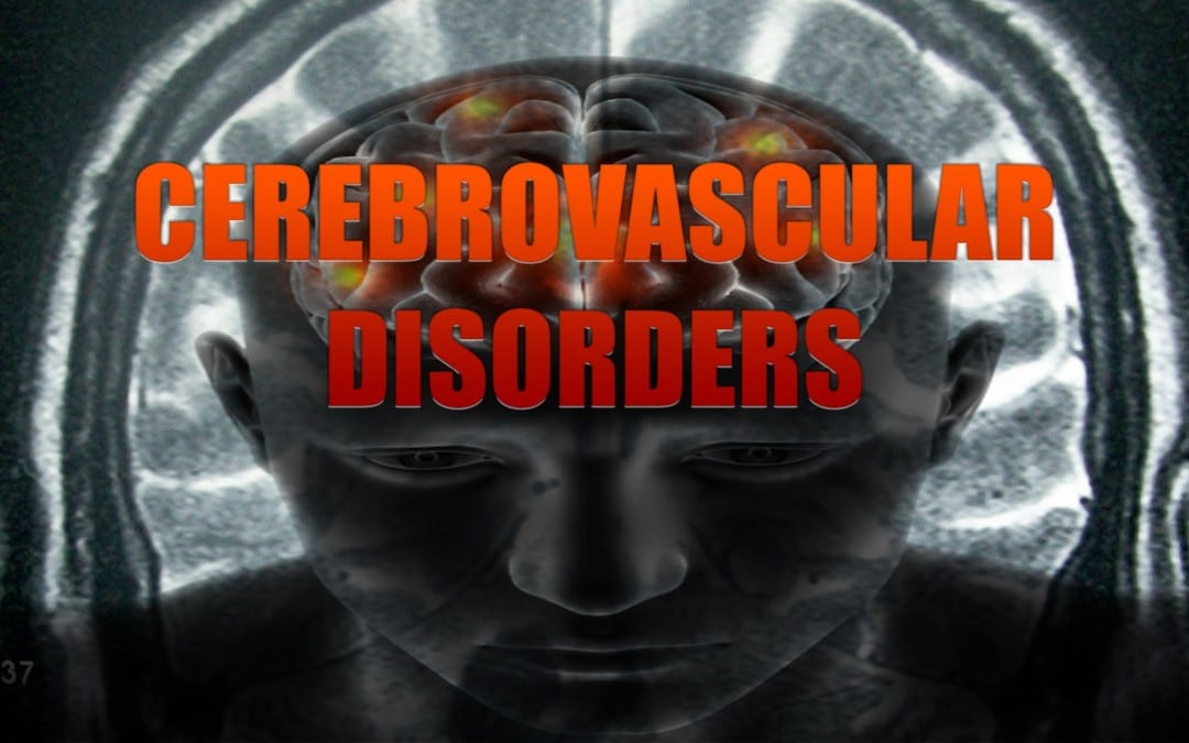 Cerebrovascular Disorders