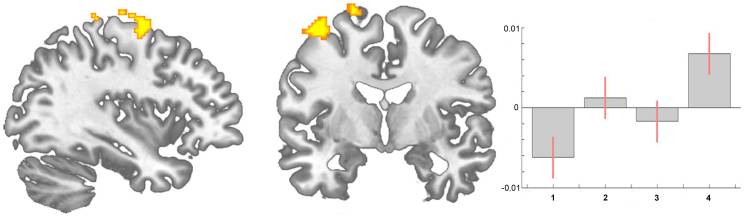 Figure 3 Statistical Parametric Maps