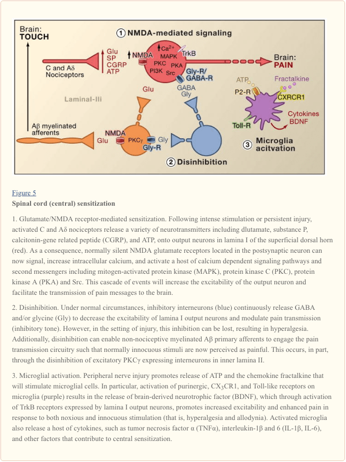 Gambar 5 Spinal Cord Central Sensitization