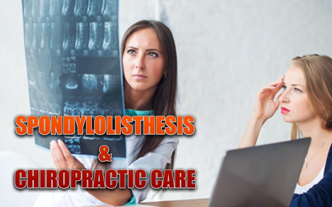 Spondylolisthesis And Chiropractic Care