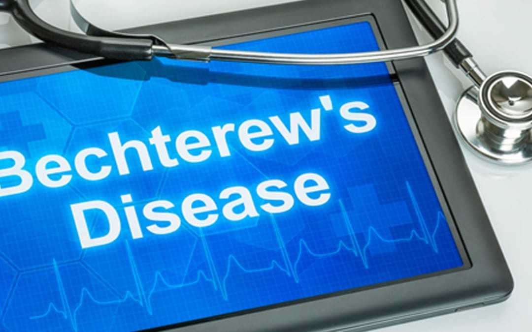 Ankylosing Spondylitis Sufferers Find Relief With Chiropractic. El Paso, TX.