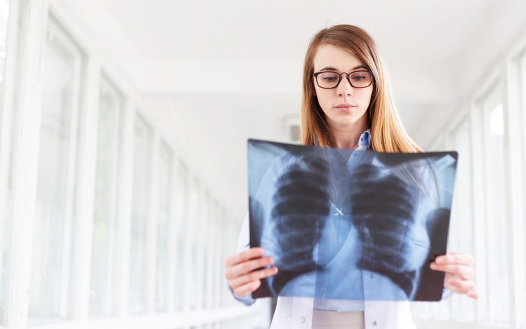 How Chiropractic Can Help Put A Rib Back Into Place | El Paso, TX.