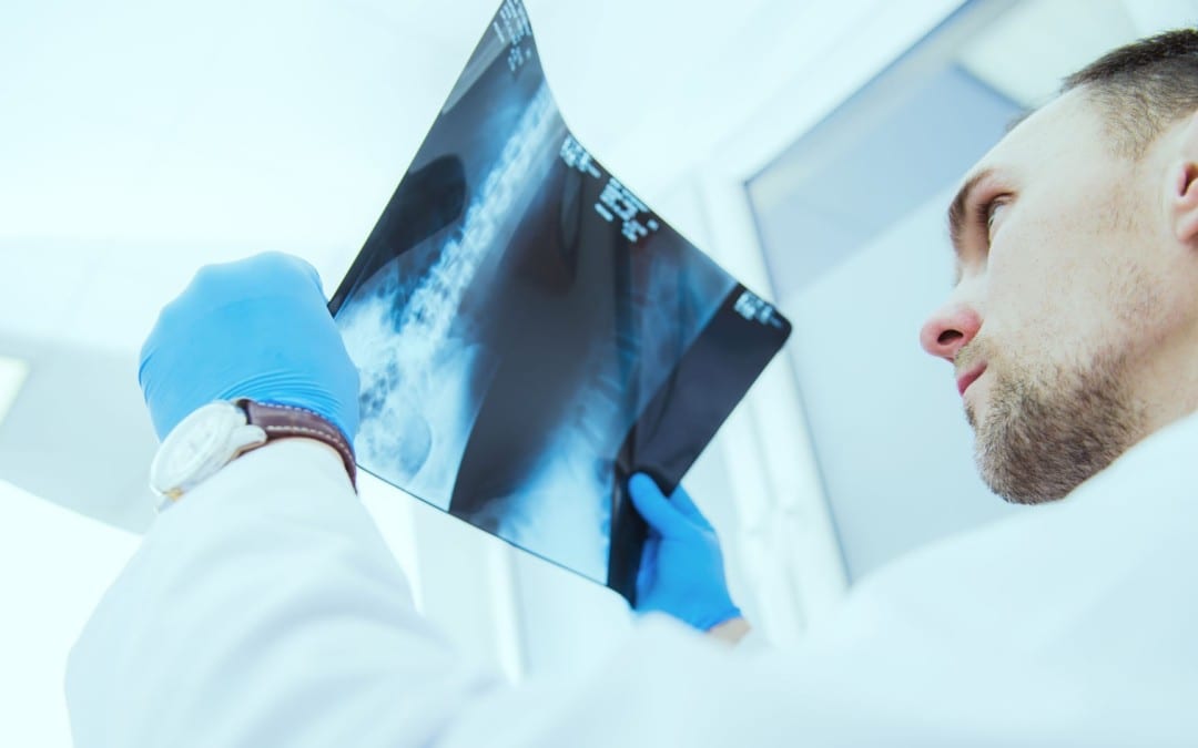 Diagnosis of Hip Complaints: Arthritis & Neoplasms Part II | El Paso, TX.