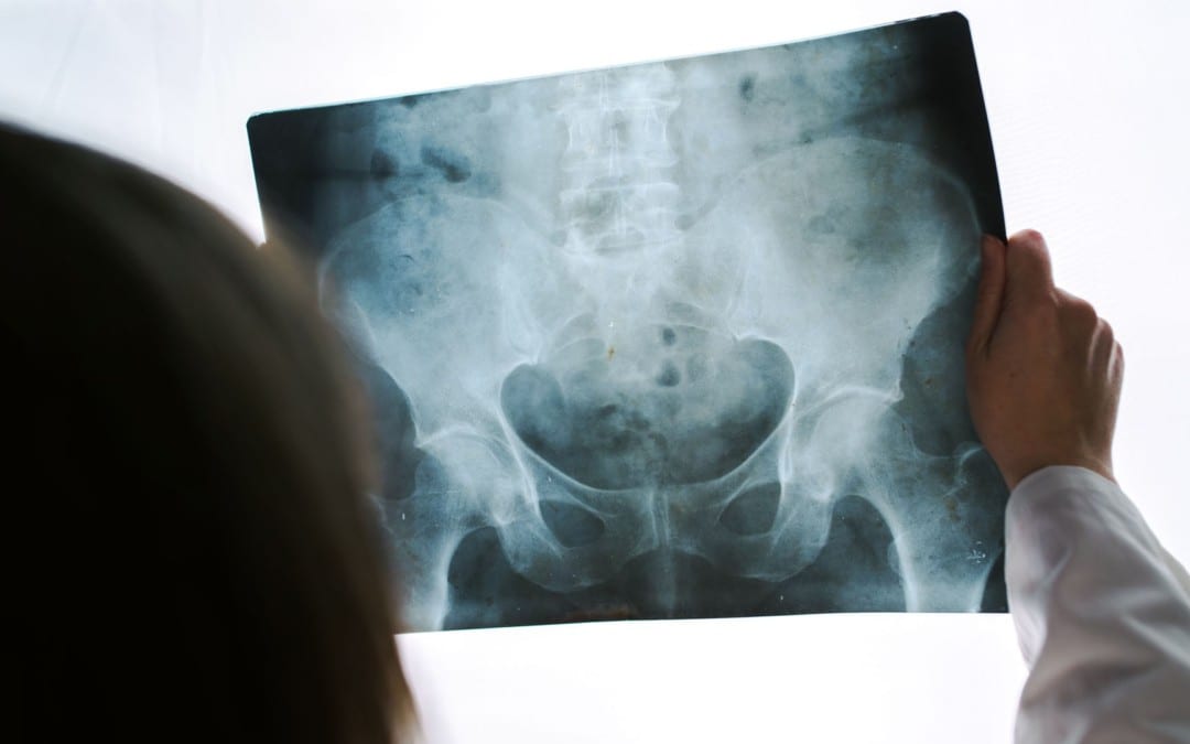 Acute Pelvis & Hip Trauma Imaging Diagnosis Part I | El Paso, TX.