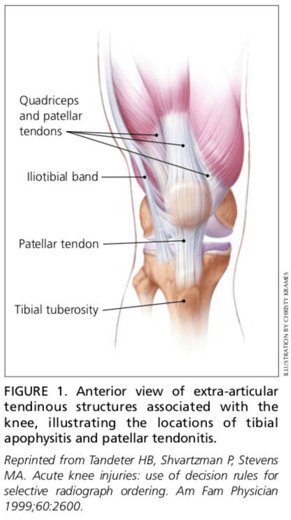 Figura 1 Vista anterior de las estructuras de la rodilla.