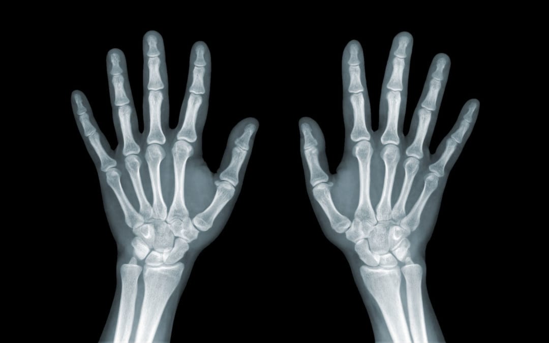 Artritis y traumatismo de muñeca / mano: diagnóstico por imágenes | El Paso, TX.