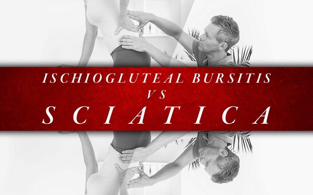Ischiogluteal Bursitis vs Sciatica