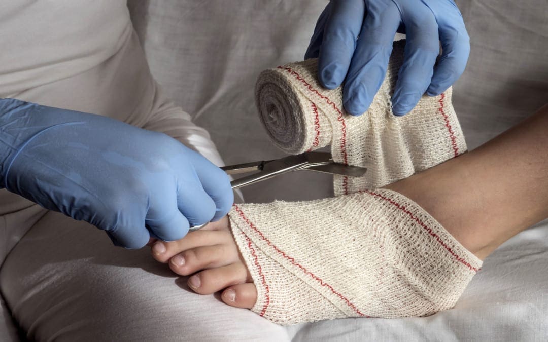 Ankle Sprain Injury Degree & How Chiropractic Can Help