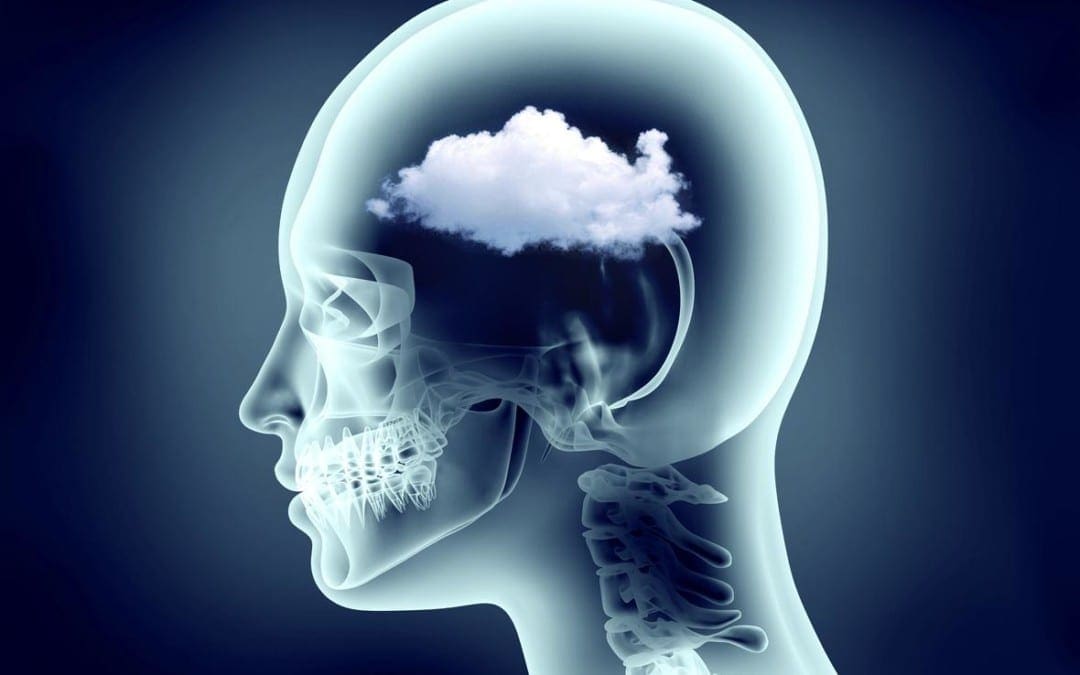 Functional Neurology: Understanding Brain Fog and Head Pain