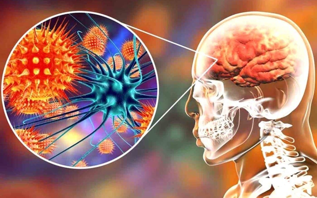 Functional Neurology: Understanding Autoimmune Brain Disease